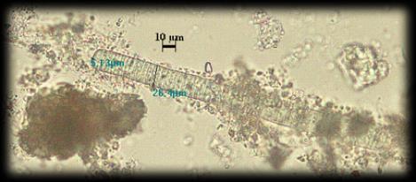 Familya: Oscillatoriaceae Genus: Lyngbya C.