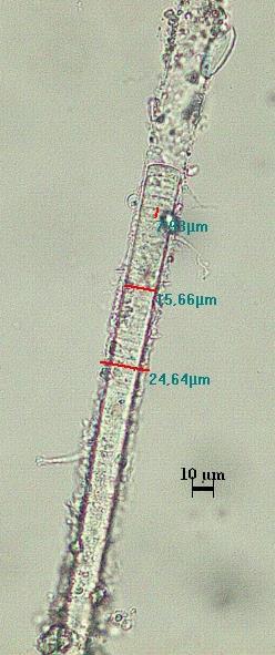 Filamentler düzdür ve trikom yoktur veya apekse doğru çok hafifçe incelmiş olarak bulunur. Trikom yaşlı olanlarda belirsizce kapitattır.