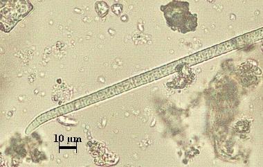 Phormidium ambiguum Gomont Granüllü hücresel içeriği ile, zeytin-yeşilden mavi-yeşile kadar trikomlar mevcut.