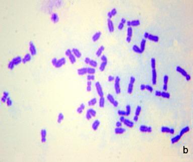 lenfositlerinde oluşan kromozomal