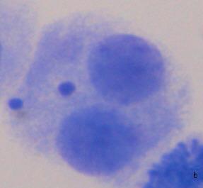 hücreler a) bir MN li binükleat b) iki MN li binükleat c) dört MN li binükleat Sitrik asit ve fosforik asit