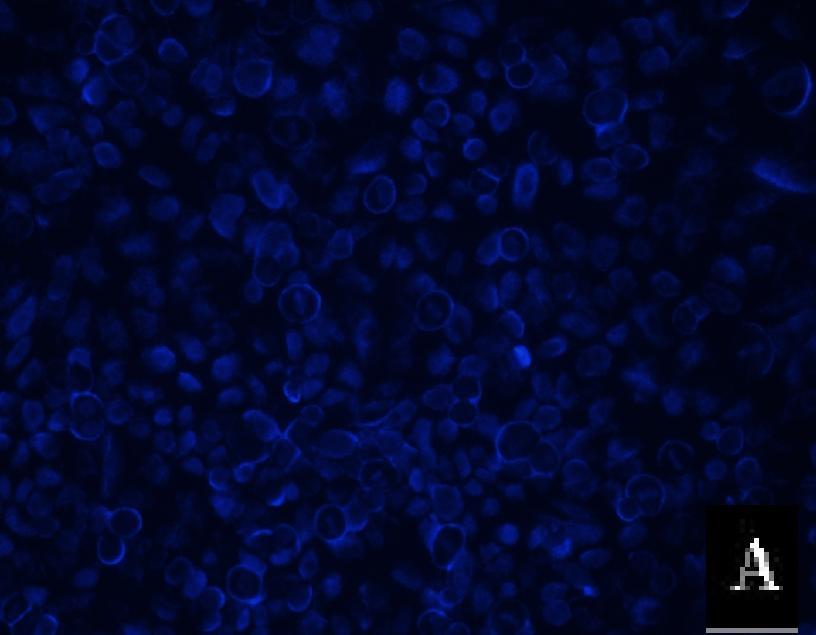 hücrelere göre daha parlak mavi renkte olduğu görülmüştür. 25 nm sirna ile inhibe edilen hücrelerde apoptotik etkinin % 20 civarında olduğu tespit edilmiştir. Şekil 4.11.