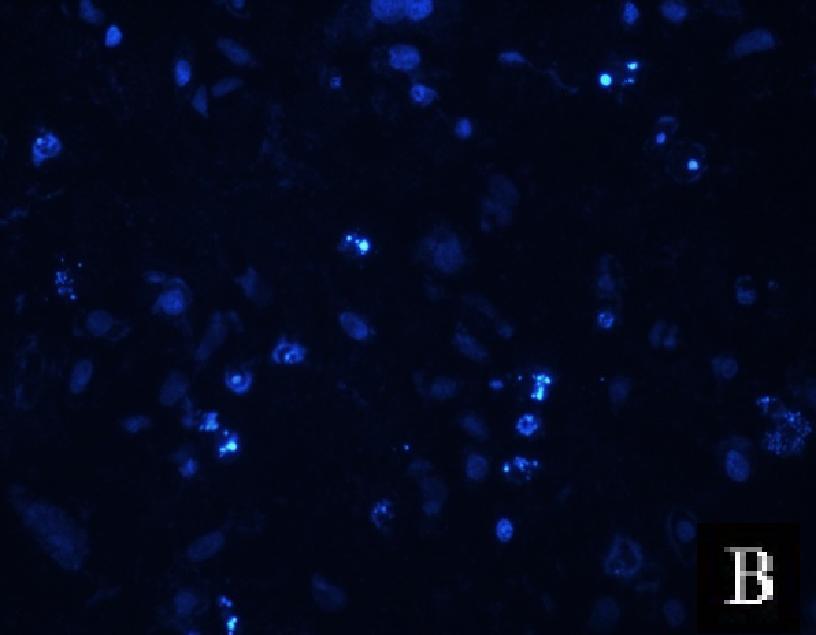 (kontrol grubu); Hücreler komplekslerle etkileştirilmediğinden apoptoza uğramamış, çekirdek sınırları normal, çekirdek parçalanmamış, (B); 25 nm ABCE1 sirna ile etkileştirilmiş A 549 hücreleri, Oklar