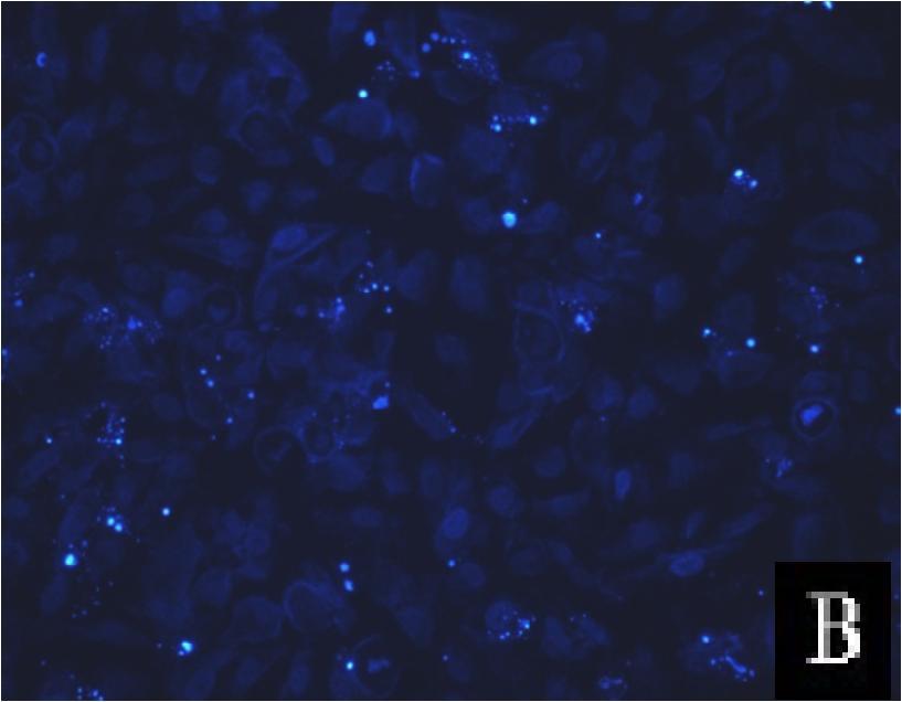 sirna ve 1 µm 5-FU ile etkileştirilmiş A 549 hücreleri.