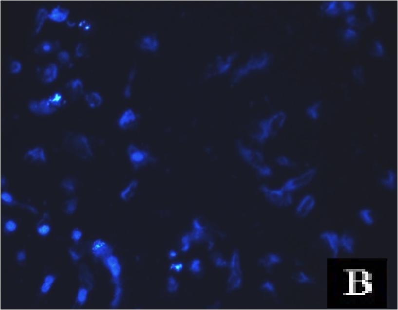 ABCE1 sirna ve 1 µm irinotecan ile etkileştirilmiş A 549 hücreleri. Oklar apoptotik hücrelerden bazılarını göstermektedir.
