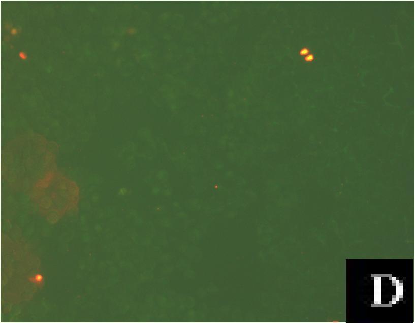 549 hücreleri, (B) 25 nm ABCE1 sirna ve 1 µm 5-FU ile etkileştirilmiş A 549 hücreleri, (C); 1 µm irinotecan ile muamele edilen A