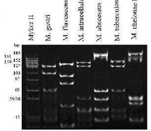 gen bölgesinin PCR ile çoğaltılıp, BstEII and