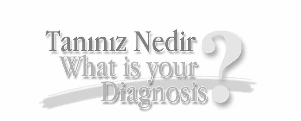 Medikal Tedaviye Dirençli ve Önceki Ablasyon Girişimi Başarısız Olan Sık Ventriküler Erken Vurulu Hasta: Tanınız nedir? Dr. Sedat KÖSE*, Dr. Hasan Kutsi KABUL*, Dr.