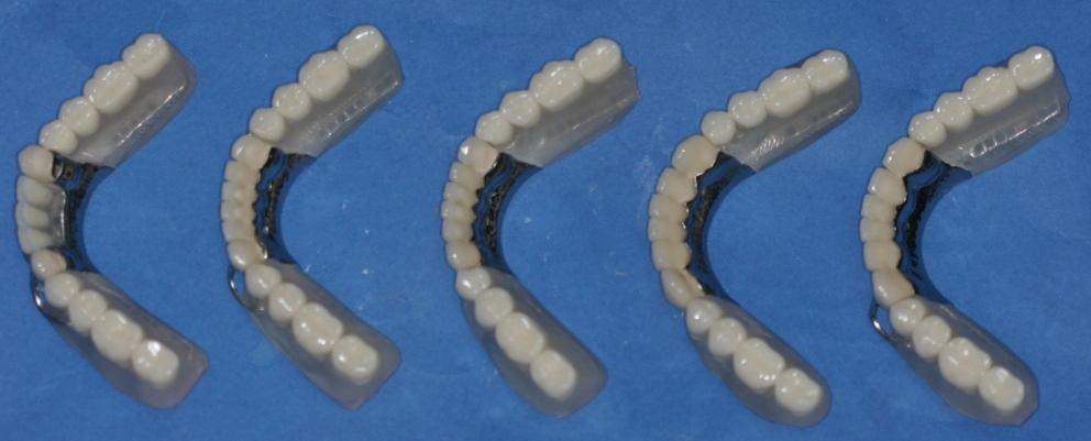 Diş dizimlerinin kontrolünden sonra hareketli protezlerin bitim prosedürleri bilinen şekilde uygulandı.