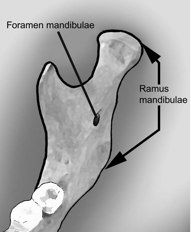 Foramen mandibulae