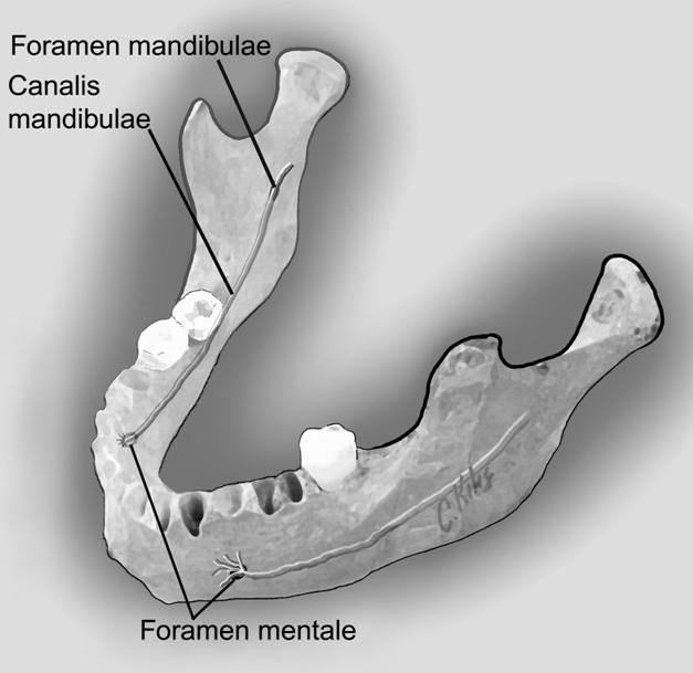 Foramen mentale