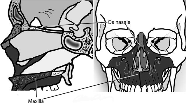 Apertura piriformis (burunun oturduğu armut