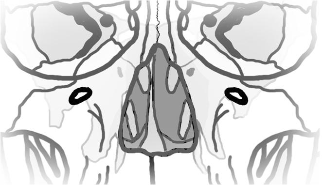 22 Foramen infraorbitale (göz boşluğunun altındaki delik) Sinus
