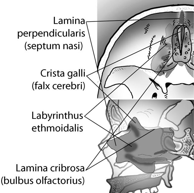 Etmoidal kemik