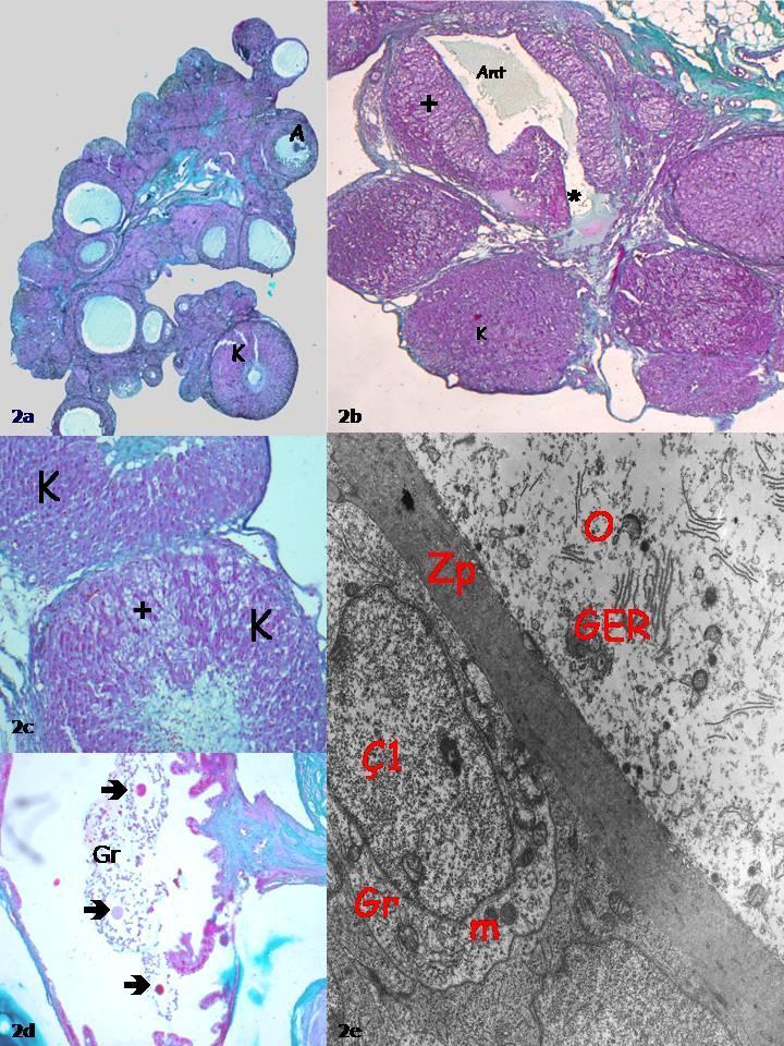 Resim 2: Sham Kontrol Grubu:K; Korpus luteum, A; Atretik follikül, + ; luteinize olan hücreler,ant; Antrum,*; follikül sıvısı, Gr: tuba uterina lümenindeki granüloza hücreleri, ;Tuba uterina