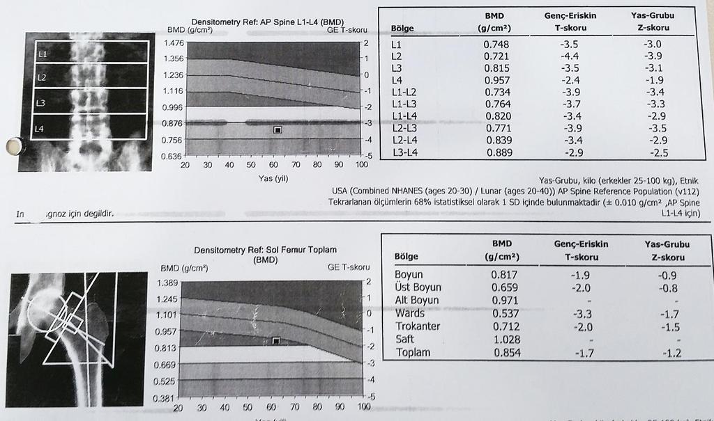 DEXA