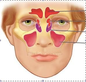 Sinüsler Frontal sinüsler 6 ila 8 yaşından itibaren radyolojik olarak ayırım yapılabilir.