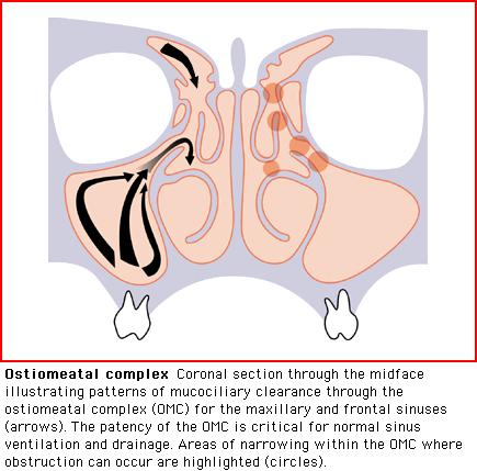 Osteomeatal complex 21.04.