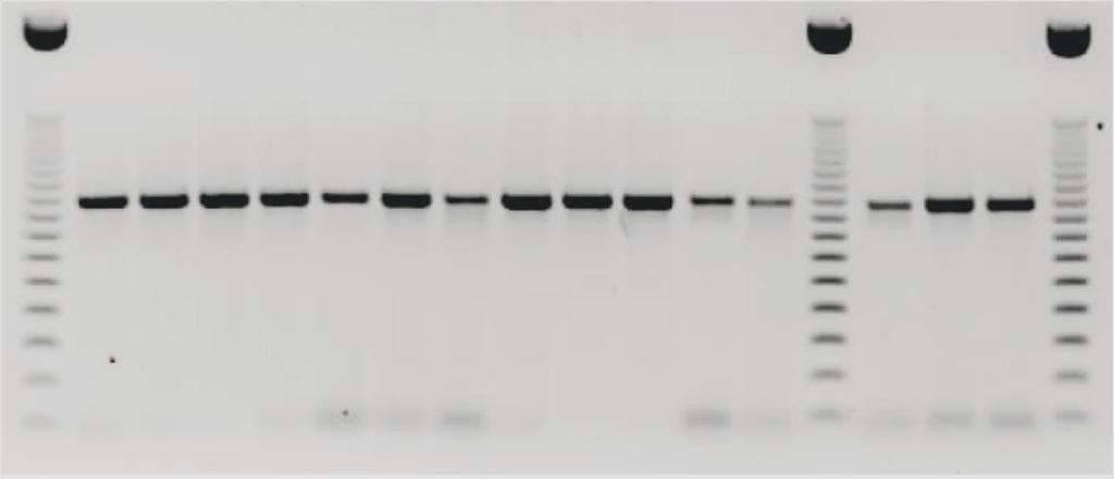 TDM DNA 25 mm MgCl 2 dh 2 O 10 mm dntp 10X buffer Hot start taq DNA polimeraz Primer 1 (Tb 11): 5' ACCAACGATGGTGTGTCCAT 3 Primer 2 (Tb 12): 5' CTTGTCGAACCGCATACCCT 3 dh 2 O 35,5 μl MgCl 2 (25 mm) 3,0