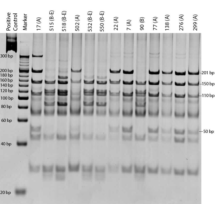 Giardia pozitif örneklerin RFLP sonuçları HaeIII