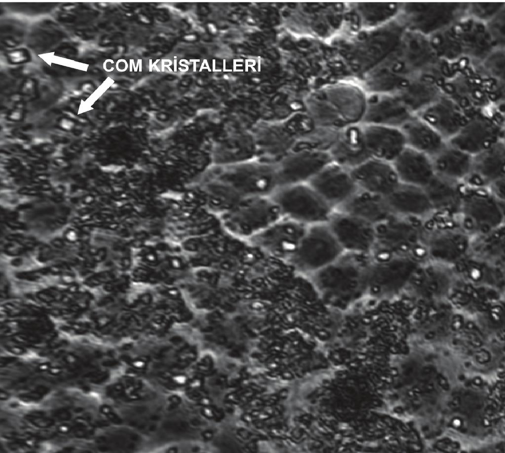 Figure 1. Phase-contrast microscopy images of control () and 0,06 M CaCl2 treated () MDCK cells. Şekil 2.