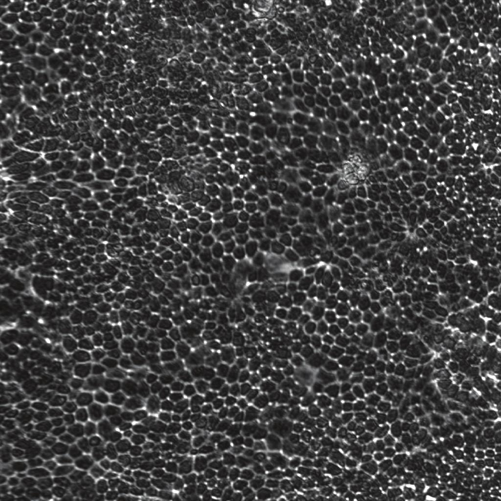 Neslihan Taşçene - Hilal Karagül 238 Şekil 4. Kontrol grubu MDCK hücrelerinin () ve 0,01 M Na2HPO4 eklenmiş MDCK hücrelerinin () faz kontrast mikroskobik Figure 4.