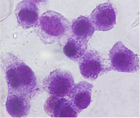 96 Şekil 8.34. UV ışık altında nanopartiküllere maruz kalan L.tropica promastigotları ile enfekte olmuş makrofaj hücreleri 8.15.