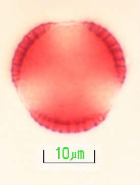 72 EK-1 (Devam) Beypazarı ballarında bulunan polenlerin mikrofotoğrafları Resim 1.7 a.