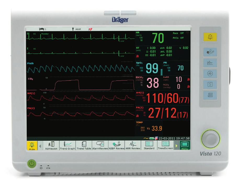 Vista 120 Hasta Monitörizasyonu Çözümü Hastanelerin ortak bir sorunu vardır: Hasta sayısının arttığı, mali kısıtlamaların fazlalaştığı ve sağlık personelinin yükünün çoğaldığı bir ortamda mümkün olan