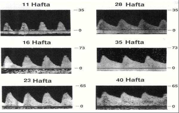 Obstetride Arteriel Doppler: 1) Umbilikal Arter: Doppler ultrasonografinin obstetride kullanılması ile birlikte ilk ve en çok incelenen damar umbilikal arter (UA) olmuştur.