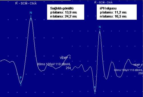 Tablo1. Çalışma gruplarının demografik özellikleri Tablo 2.