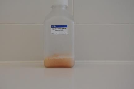 içeriği; % 15 Fetal Bovin Serum (FBS)