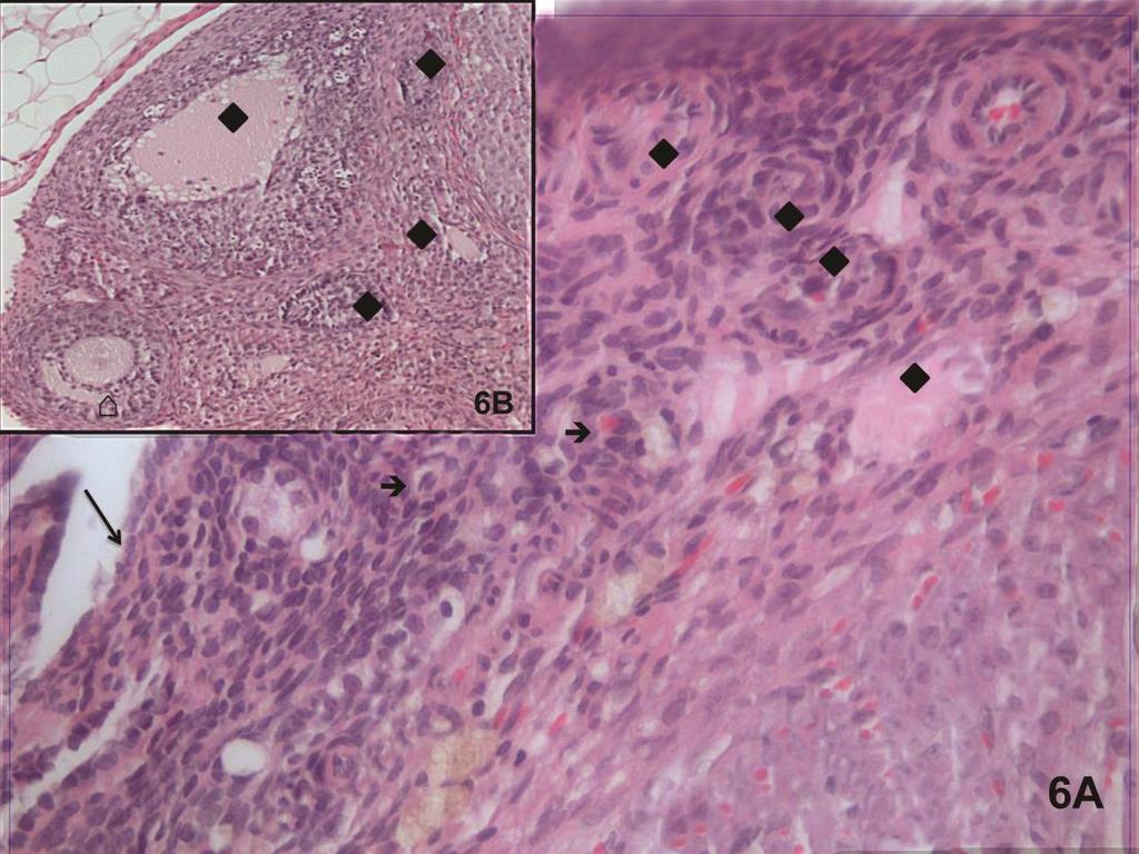 Resim 6A,B: Radyasyon uygulanan grupta primordiyal folliküller ( ), korpus luteum ve germinal epitel ( ) normal yapıda izleniyor.