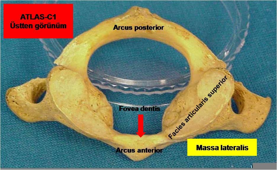 5 bağlayan kemere de arcus posterior atlantis denilir.