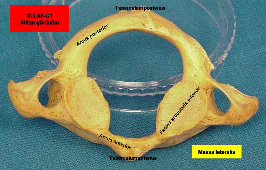 6 Şekil 3: Atlas ın (C1) alttan görünümü. Axis (C2): Diğer boyun omurlarından en önemli farkı dens axis inin olmasıdır. Dens axis, omurun korpusunun üst kısmının ortasından yukarı doğru uzanır.