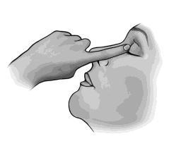 Bir an için gözünüzü kapatınız ve gözünüzün iç tarafına parmağınızla yaklaşık bir dakika bastırınız. Bu, göz damlasının göz yaşı kanalından dışarı akmasını önleyecektir. 12.