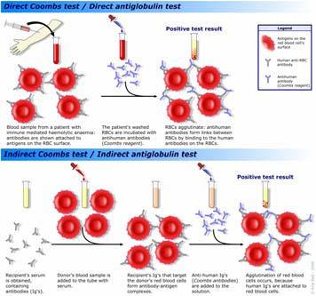 hemolitik anemi Drug-adsorbtion tip hemolitik anemi Neoantijen tip ilaç ile ilişkili hemolitik anemi Otoimmün hemolitik anemi Kendi eritrositleri