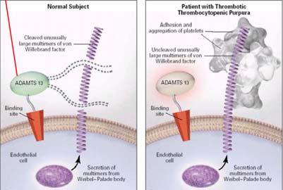 TTP Ateş Nörolojik bulgular Trombositopeni (< 20.000 ) MAHA Renal yetmezlik =TTP wvf katabolizma bozukluğudur.