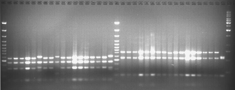 112 16S rrna-its bölgesi amplifiye edilemeyen 17 adet izolat PCR/RFLP (16S rrna) yöntemi kullan larak tan mlanmaya çal lm t r. 17 izolattan 16 s n n ve V1KL12 izolat n n jel görüntüleri hem Lb.