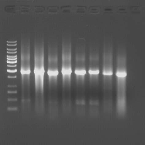 59 2000 bp 1500 bp Resim 3.4. 16S-ITS Amplifikasyon Ürünlerinin (1500-2000 bp lik) Jel Görüntüsü 3.2.5.2.5 PCR Ürünlerinin Restriksiyon Endonükleazlar le Kesimi (RFLP -Restriction Fragment Length