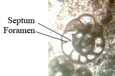 Yaş :E.Carbonifer Loca Sarılımı :Planispiral Duvar Yapısı :Perforate Calcerous Hyaline/Microgranular Yaşam Şekli :Benthic Kesit Tipi :Aksiyal 2.