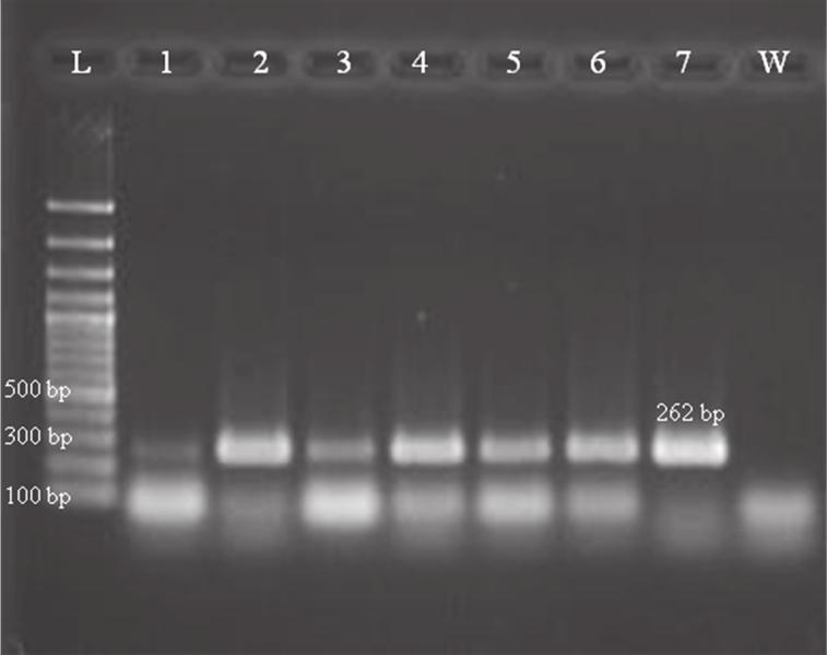 A. KAYA, S. ERİLMEZ Şekil 6. GFkV için uygulanmış olan RT-PCR testi sonucunun jel görüntüleme sisteminde çekilmiş fotografı Şekil 7.