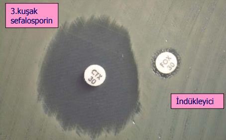 Sefepim Sefoksitin Dirençli Sefamisinler, karbapenemler, 3 ve 4.
