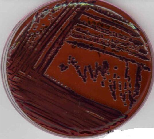 Olgu Klebsiella pneumoniae ANTİBİYOTİKLER Amikasin Ampisilin Sefazolin Sefepim Seftazidim