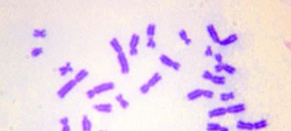 kromatid kırığı b) kromozom