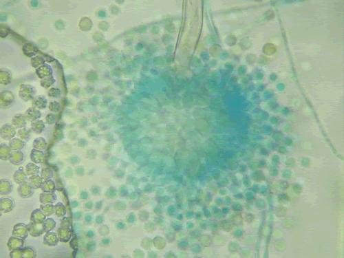 Aspergillus fumigatus