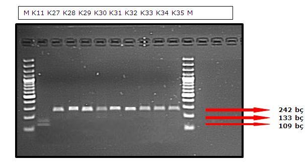 Şekil 3.3. TNF-R2 geninin (+587 T/G) bölgesinin Hin1II enzimi ile kesimi sonucu K11, K27-K35 numaralı kontrollerden elde edilen RFLP ürünlerinin jeldeki görüntüsü. (M:100 bç lik belirteç).