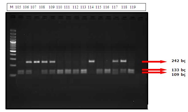 Şekil 3.4. TNF-R2 geninin (+587 T/G)polimorfik bölgesinin Hin1II enzimi ile kesimi sonucu 105-119 numaralı hastalardan elde edilen RFLP ürünlerinin jeldeki görüntüsü. (M:100 bç lik belirteç) Şekil 3.