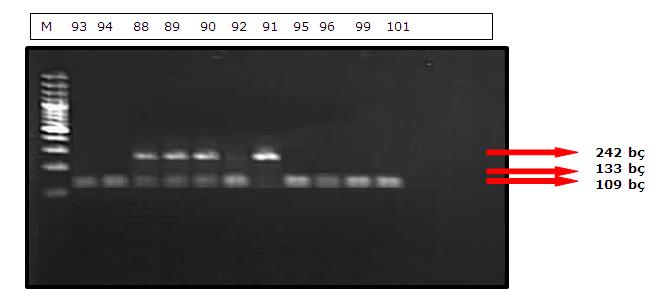 Şekil 3.5. TNF-R2 geninin (+587 T/G) polimorfik bölgesinin Hin1II enzimi ile kesimi sonucu 93,94,88,89,90,92,91,95,96,99,101 numaralı hastalardan elde edilen RFLP ürünlerinin jeldeki görüntüsü.
