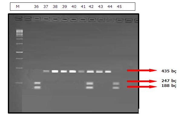 Şekil 3.8. MMP-9 geninin (-1562 C/T) bölgesinin PaeI enzimi ile kesimi sonucu 36-45 numaralı hastalardan elde edilen RFLP ürünlerinin jeldeki görüntüsü.( M : 250 bç lik belirteç) Şekil 3.8. de her üç genotipe ait fragmenti içeren bir jel görüntüsü yer almaktadır.